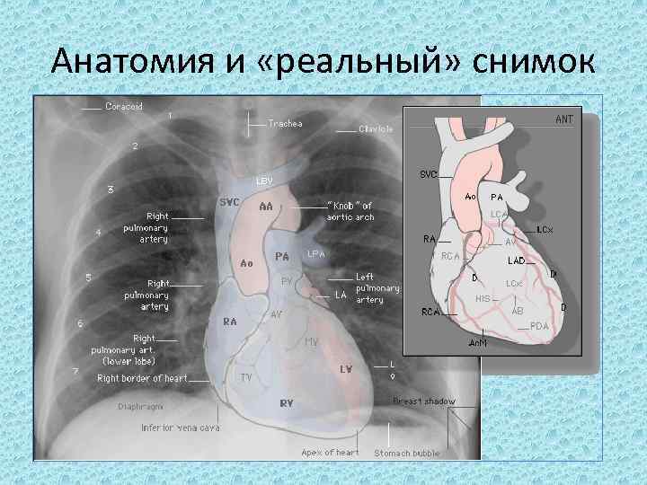 Анатомия и «реальный» снимок 