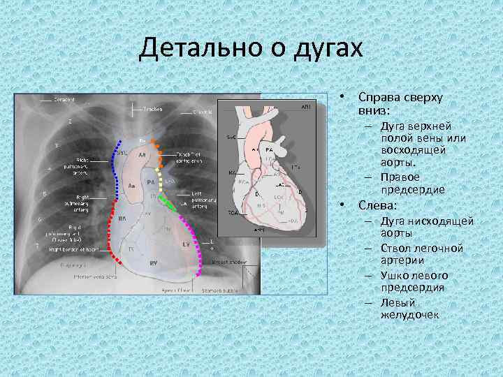 Детально о дугах • Справа сверху вниз: – Дуга верхней полой вены или восходящей