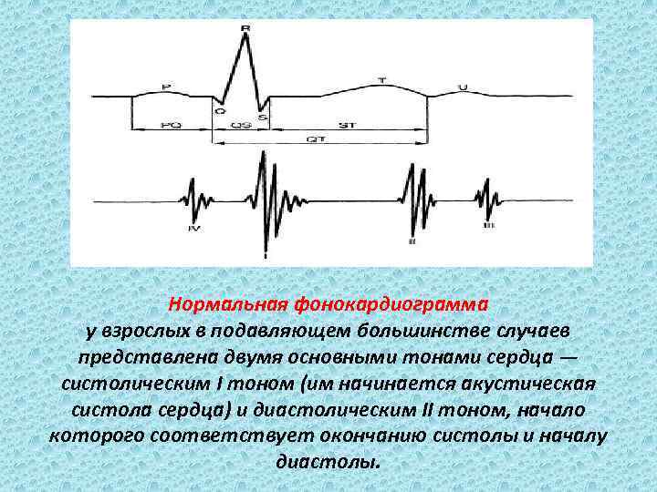 Нормальная фонокардиограмма у взрослых в подавляющем большинстве случаев представлена двумя основными тонами сердца —