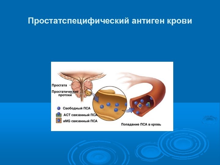 Простатспецифический антиген крови 