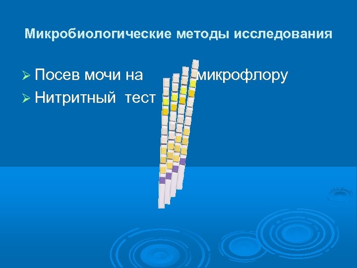 Микробиологические методы исследования Посев мочи на Нитритный тест микрофлору 