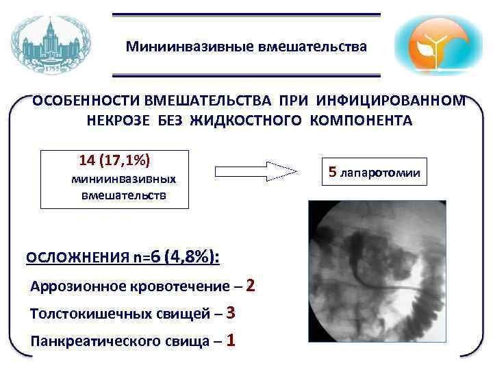 Миниинвазивные вмешательства ОСОБЕННОСТИ ВМЕШАТЕЛЬСТВА ПРИ ИНФИЦИРОВАННОМ НЕКРОЗЕ БЕЗ ЖИДКОСТНОГО КОМПОНЕНТА 14 (17, 1%) миниинвазивных