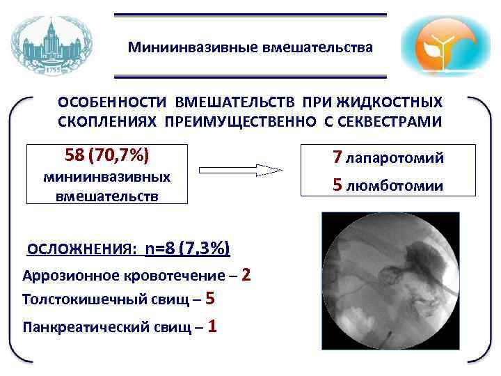 Миниинвазивные вмешательства ОСОБЕННОСТИ ВМЕШАТЕЛЬСТВ ПРИ ЖИДКОСТНЫХ СКОПЛЕНИЯХ ПРЕИМУЩЕСТВЕННО С СЕКВЕСТРАМИ 58 (70, 7%) миниинвазивных