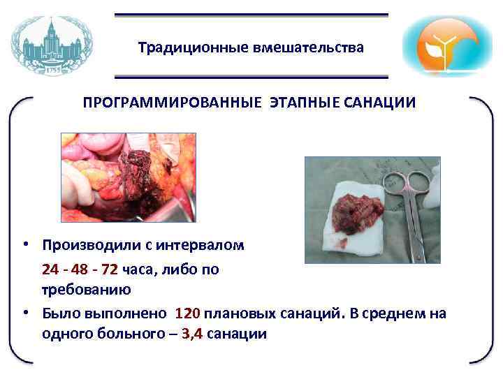 Традиционные вмешательства ПРОГРАММИРОВАННЫЕ ЭТАПНЫЕ САНАЦИИ • Производили с интервалом 24 - 48 - 72