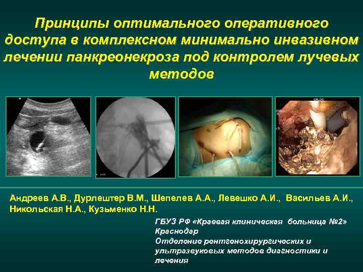 Принципы оптимального оперативного доступа в комплексном минимально инвазивном лечении панкреонекроза под контролем лучевых методов