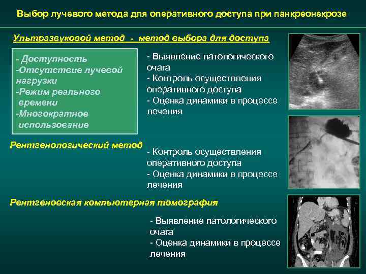 Выбор лучевого метода для оперативного доступа при панкреонекрозе Ультразвуковой метод - метод выбора для