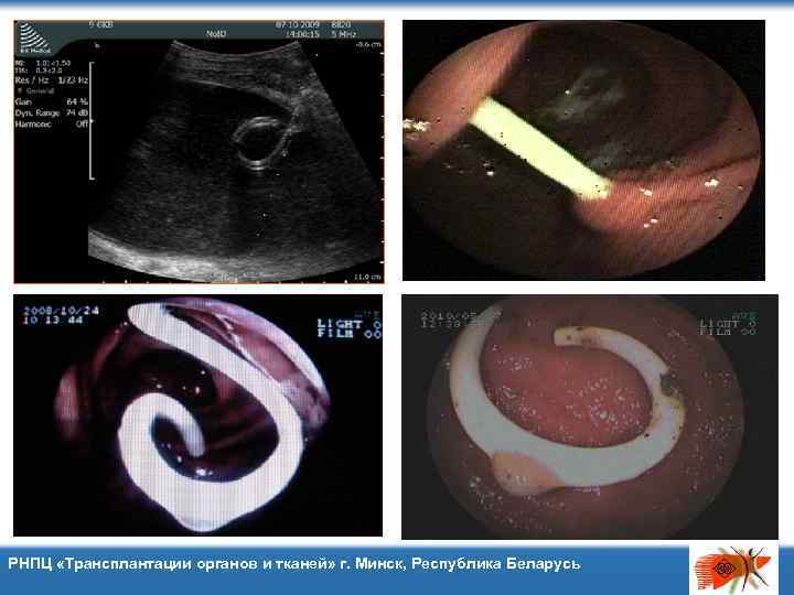 РНПЦ «Трансплантации органов и тканей» г. Минск, Республика Беларусь 