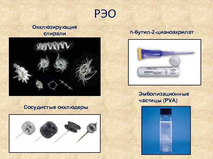 РЭО Окклюзирующие спирали n-бутил-2 -цианоакрилат Эмболизационные частицы (PVA) Сосудистые окклюдеры 