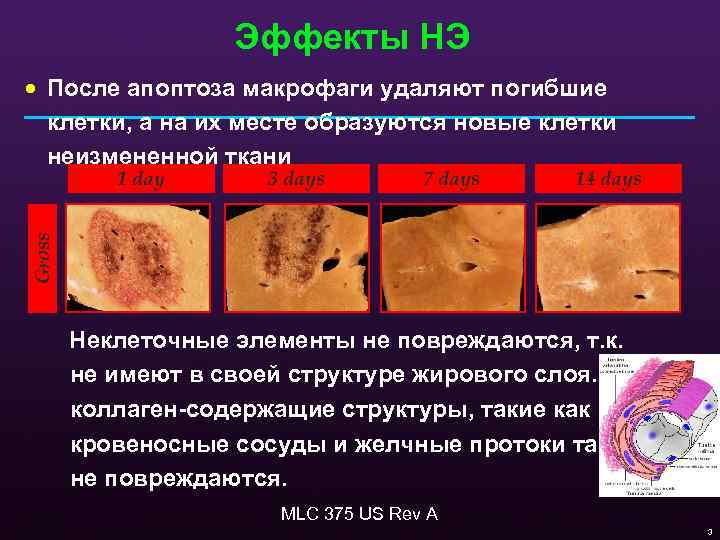 Эффекты НЭ · После апоптоза макрофаги удаляют погибшие клетки, а на их месте образуются