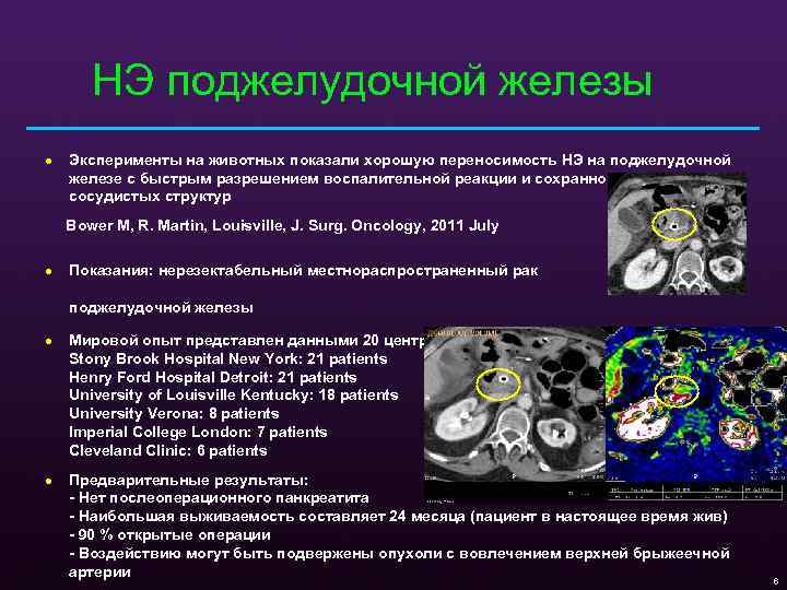 НЭ поджелудочной железы · Эксперименты на животных показали хорошую переносимость НЭ на поджелудочной железе