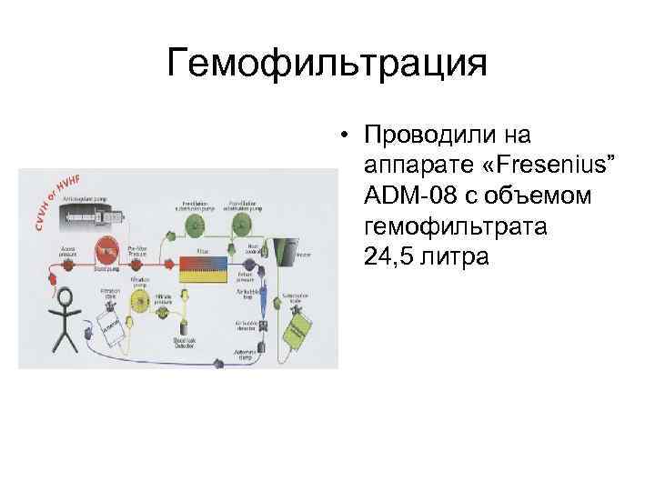 Гемофильтрация • Проводили на аппарате «Fresenius” ADM-08 c объемом гемофильтрата 24, 5 литра 