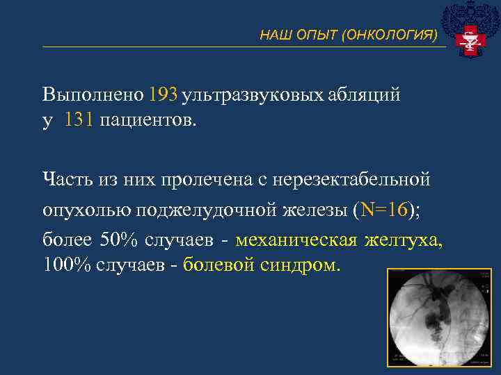 НАШ ОПЫТ (ОНКОЛОГИЯ) _____________________________ Выполнено 193 ультразвуковых абляций у 131 пациентов. Часть из них