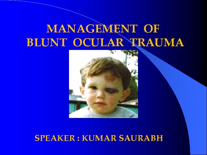 MANAGEMENT OF BLUNT OCULAR TRAUMA SPEAKER : KUMAR SAURABH 