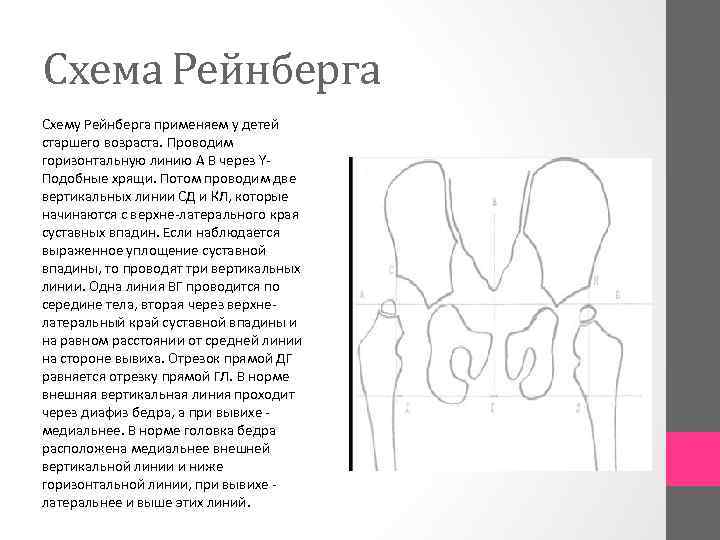 Схема Рейнберга Схему Рейнберга применяем у детей старшего возраста. Проводим горизонтальную линию А В