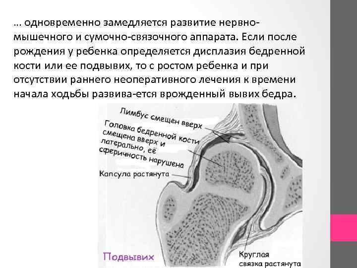 … одновременно замедляется развитие нервно мышечного и сумочно связочного аппарата. Если после рождения у