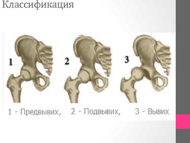 Классификация 