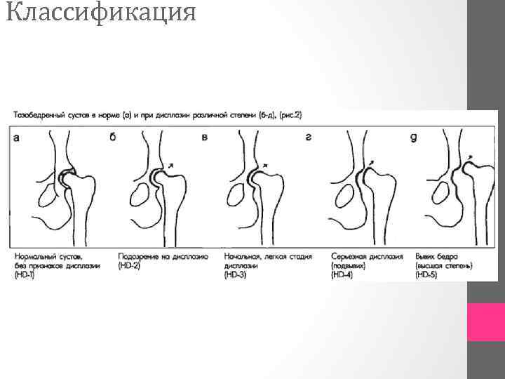 Классификация 