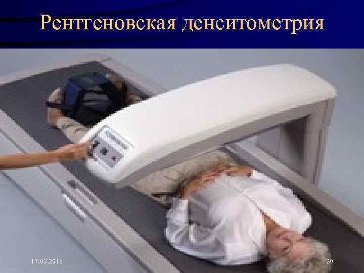 Рентгеновская денситометрия 17. 02. 2018 20 