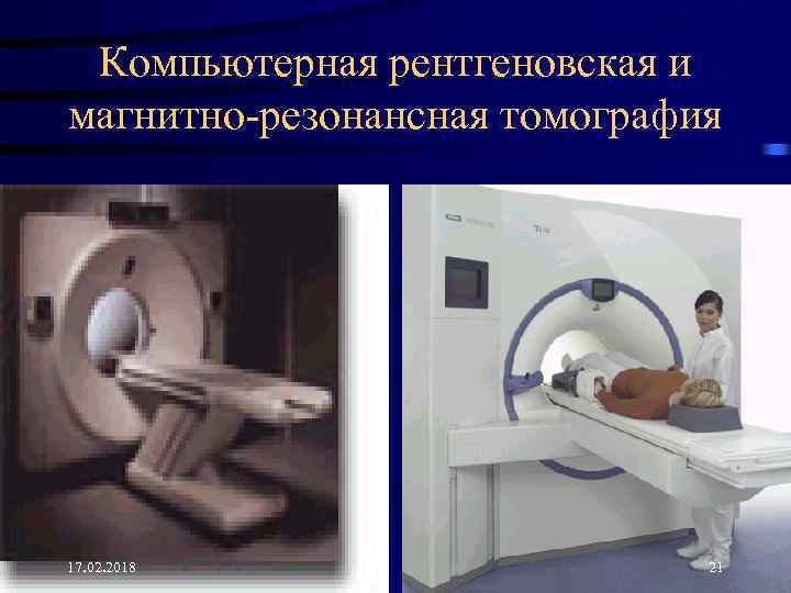 Компьютерная рентгеновская и магнитно-резонансная томография 17. 02. 2018 21 