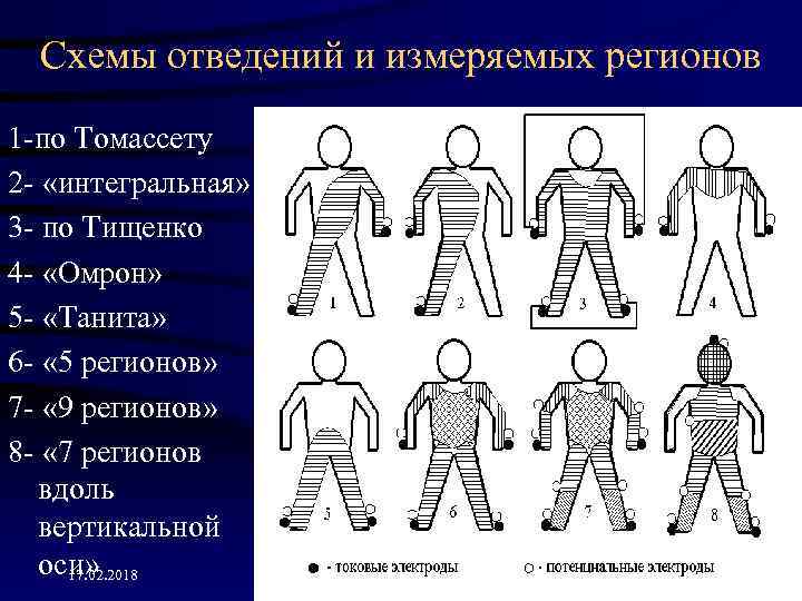 Схемы отведений и измеряемых регионов 1 -по Томассету 2 - «интегральная» 3 - по