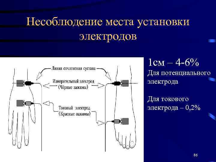Несоблюдение места установки электродов 1 см – 4 -6% Для потенциального электрода Для токового