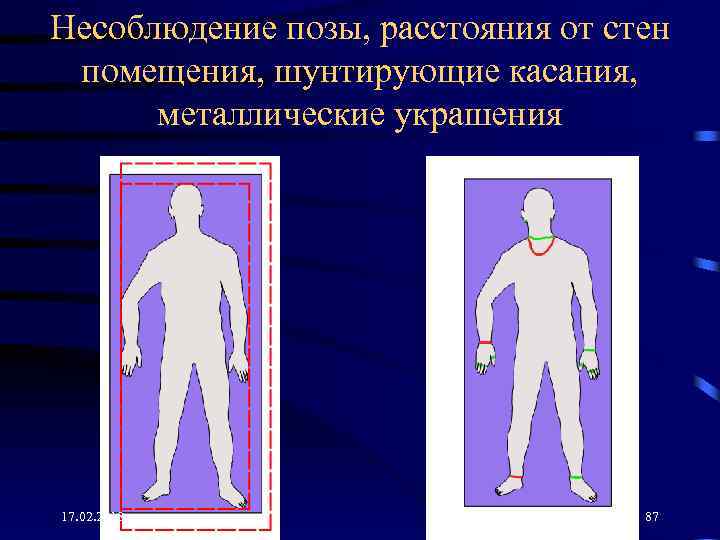 Несоблюдение позы, расстояния от стен помещения, шунтирующие касания, металлические украшения 17. 02. 2018 87