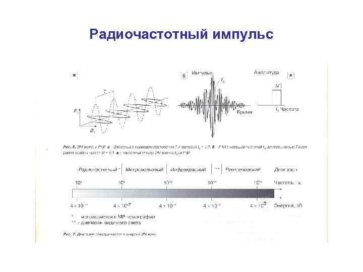 Радиочастотный импульс 