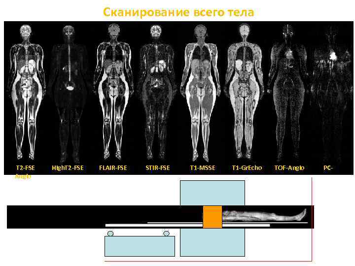 Сканирование всего тела T 2 -FSE Angio High. T 2 -FSE FLAIR-FSE STIR-FSE T