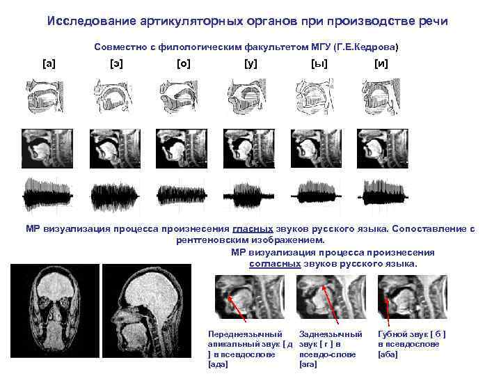 Исследование артикуляторных органов при производстве речи Совместно с филологическим факультетом МГУ (Г. Е. Кедрова)