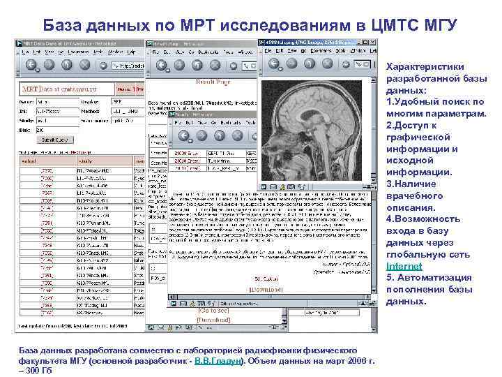 База данных по МРТ исследованиям в ЦМТС МГУ Характеристики разработанной базы данных: 1. Удобный