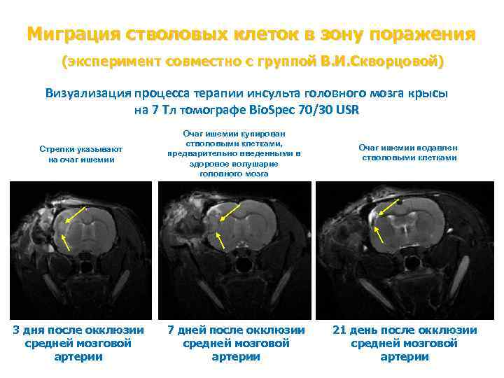 Миграция стволовых клеток в зону поражения (эксперимент совместно с группой В. И. Скворцовой) Визуализация
