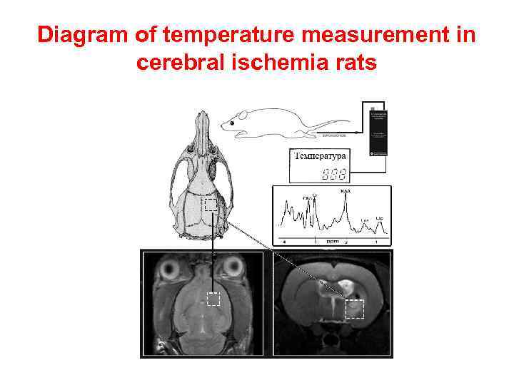 Diagram of temperature measurement in cerebral ischemia rats 