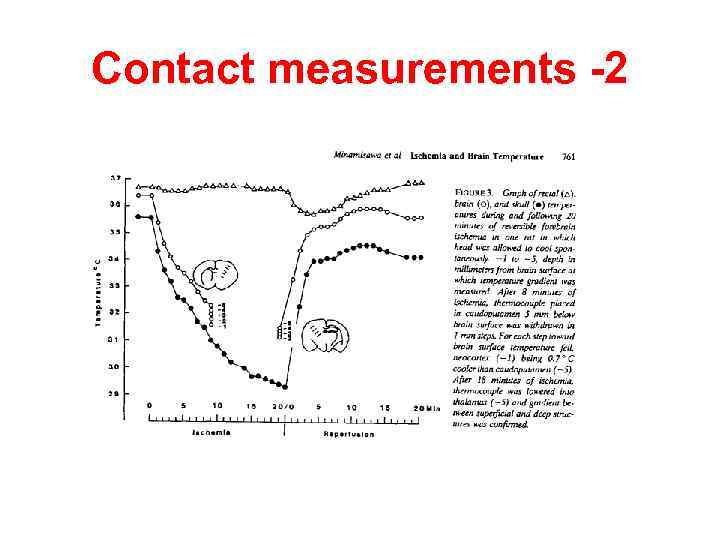 Contact measurements -2 