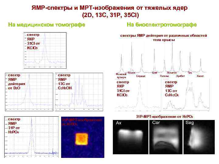 ЯМР-спектры и МРТ-изображения от тяжелых ядер (2 D, 13 C, 31 P, 35 Cl)