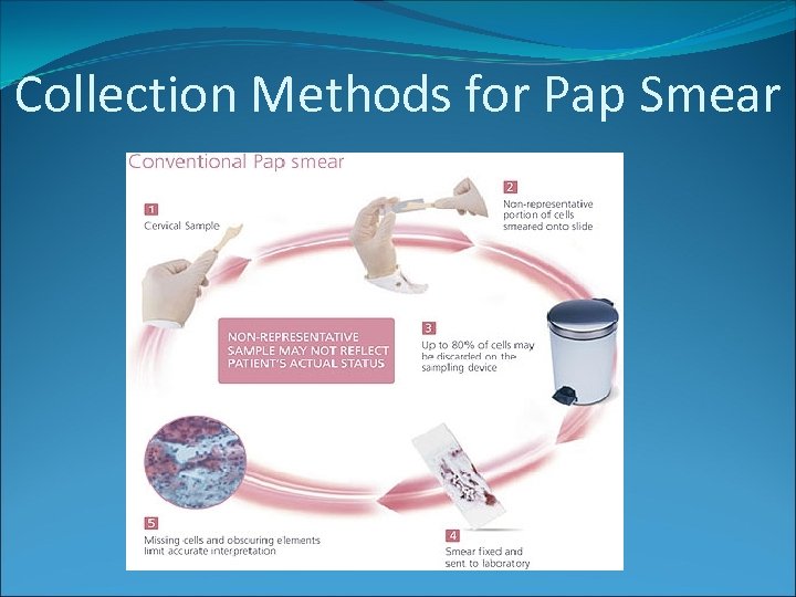 Collection Methods for Pap Smear 