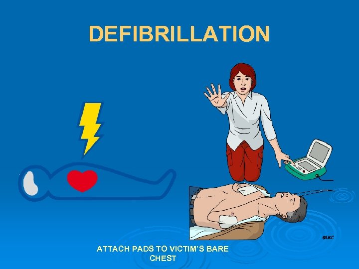 DEFIBRILLATION ATTACH PADS TO VICTIM’S BARE CHEST 