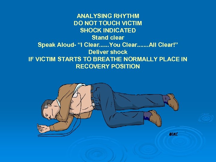 ANALYSING RHYTHM DO NOT TOUCH VICTIM SHOCK INDICATED Stand clear Speak Aloud- “I Clear.