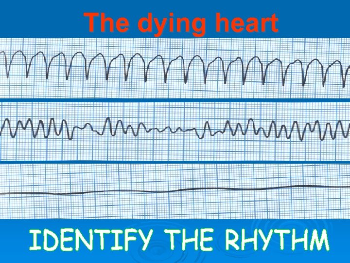 The dying heart 