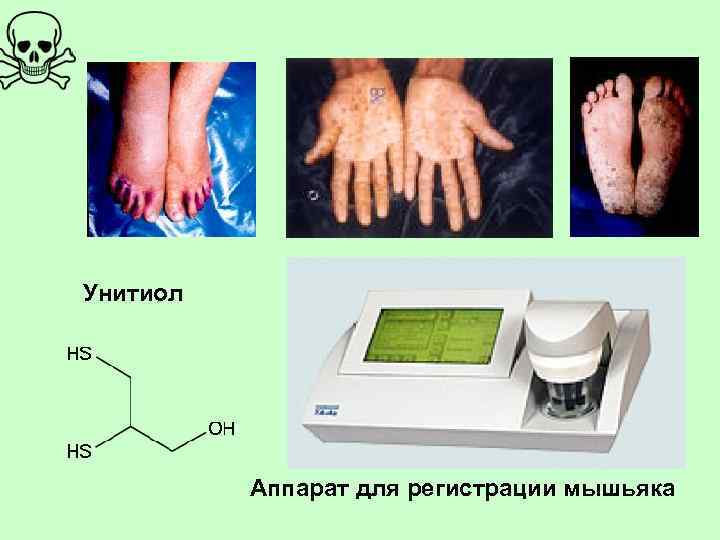 Унитиол Аппарат для регистрации мышьяка 