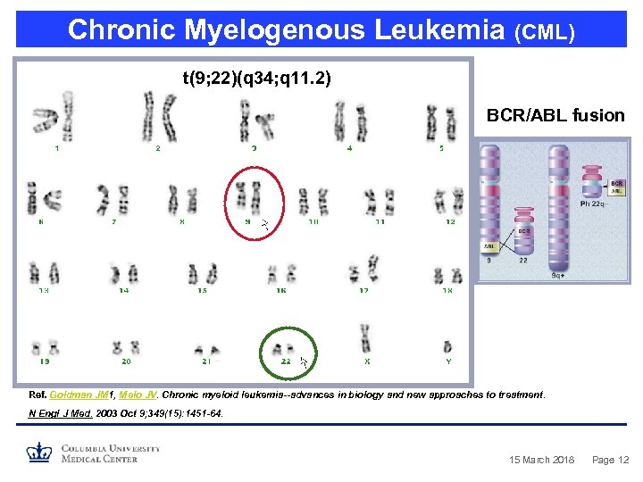 Chronic Myelogenous Leukemia (CML) t(9; 22)(q 34; q 11. 2) BCR/ABL fusion Ref. Goldman