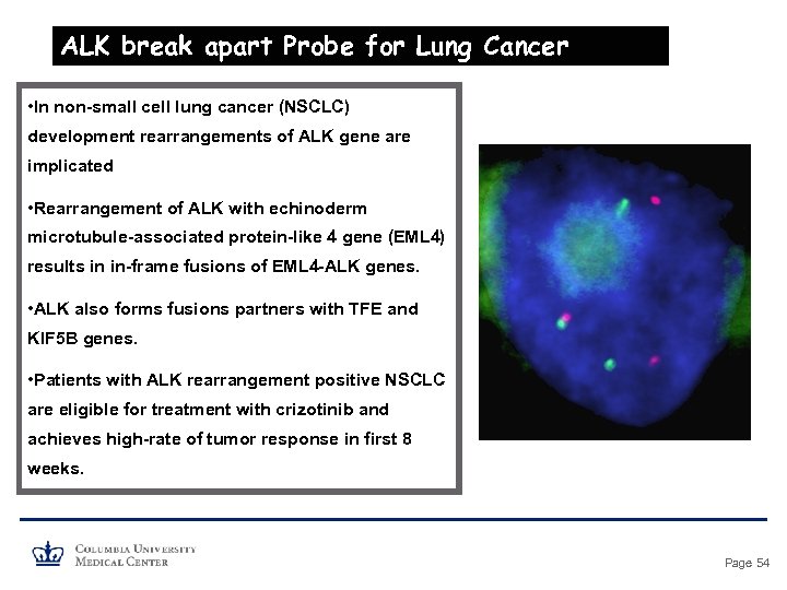 ALK break apart Probe for Lung Cancer • In non-small cell lung cancer (NSCLC)