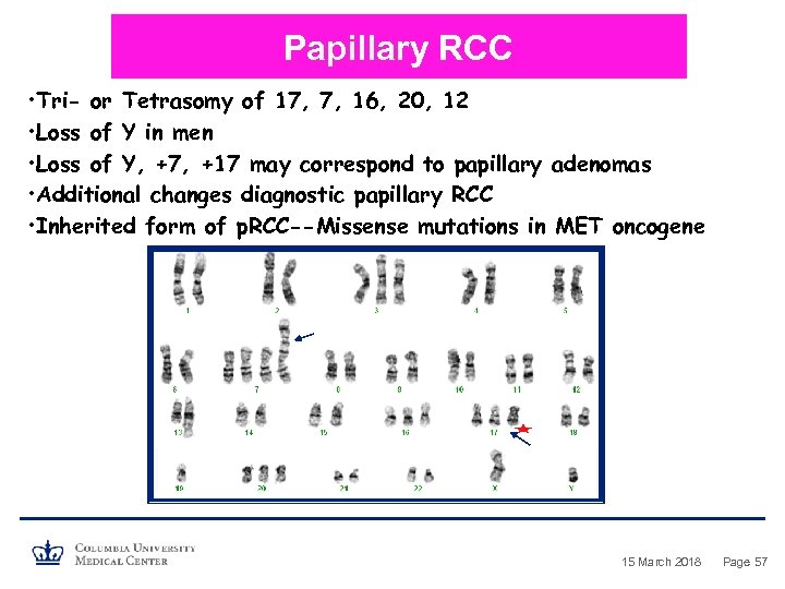 Papillary RCC • Tri- or Tetrasomy of 17, 7, 16, 20, 12 • Loss