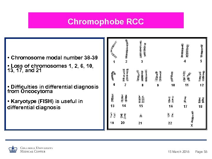 Chromophobe RCC • Chromosome modal number 38 -39 • Loss of chromosomes 1, 2,