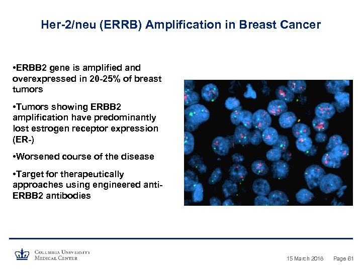 Her-2/neu (ERRB) Amplification in Breast Cancer • ERBB 2 gene is amplified and overexpressed