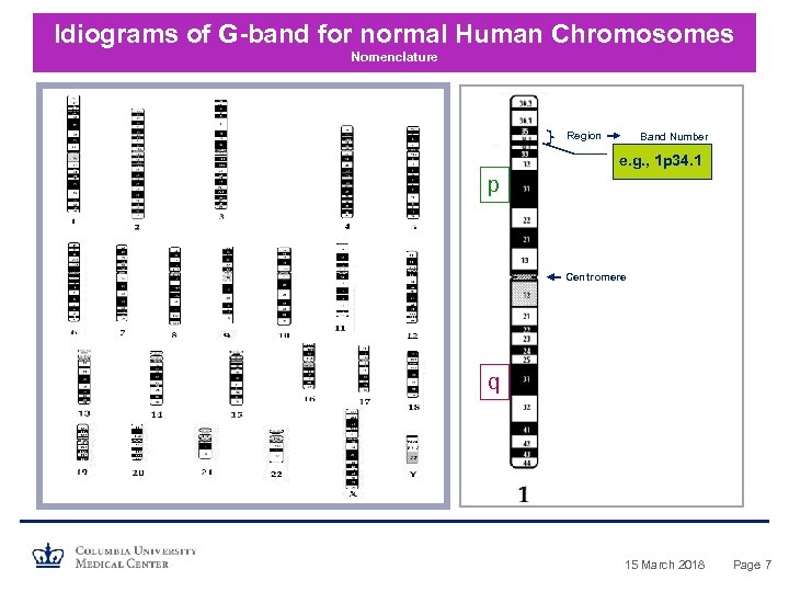 Idiograms of G-band for normal Human Chromosomes Nomenclature Region Band Number e. g. ,