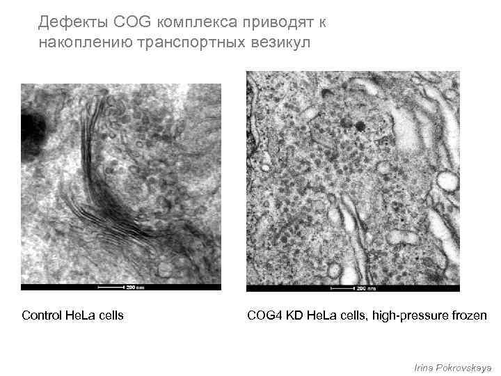 Дефекты COG комплекса приводят к накоплению транспортных везикул Control He. La cells COG 4