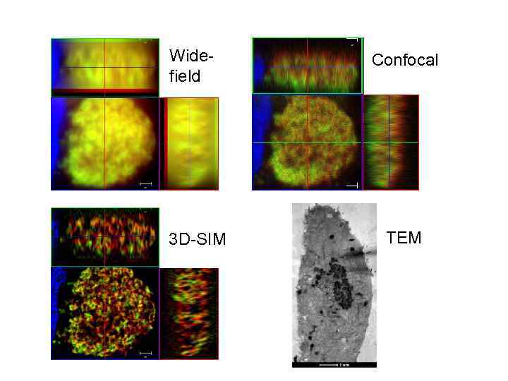 Widefield 3 D-SIM Confocal TEM 
