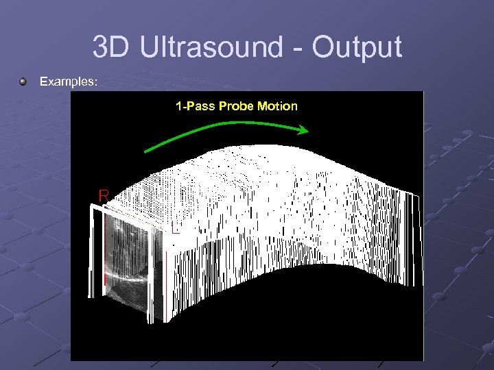 3 D Ultrasound - Output Examples: 1 -Pass Probe Motion 