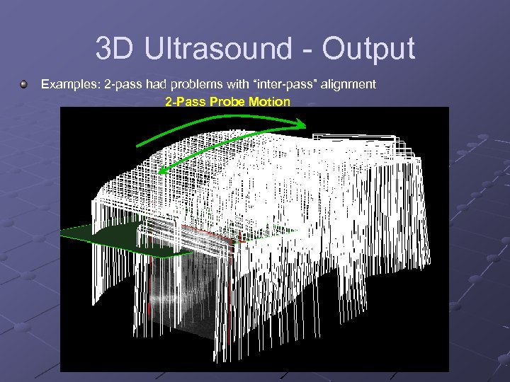 3 D Ultrasound - Output Examples: 2 -pass had problems with “inter-pass” alignment 2