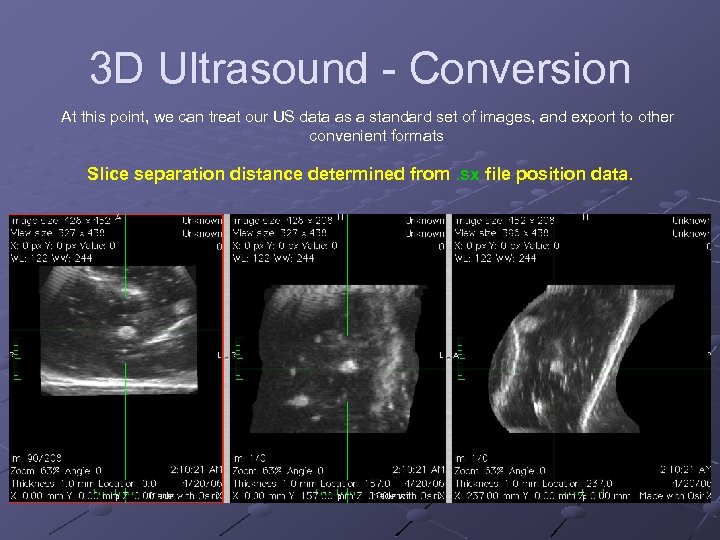 3 D Ultrasound - Conversion At this point, we can treat our US data